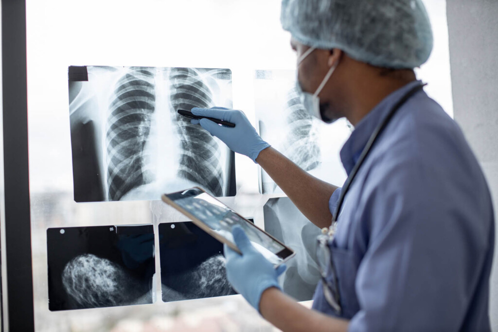 Doctor looking at chest X-Ray image.